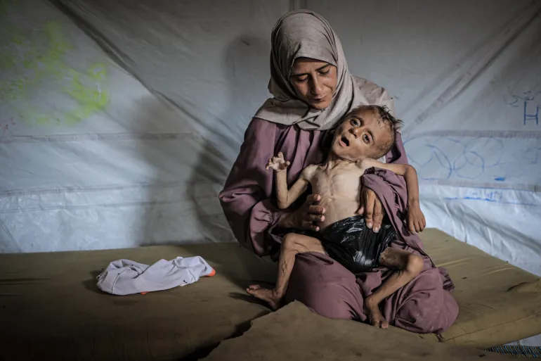 غزة: ارتفاع حصيلة وفيات المجاعة إلى 251 شخصًا بينهم 108 أطفال - Réveil d'algérie