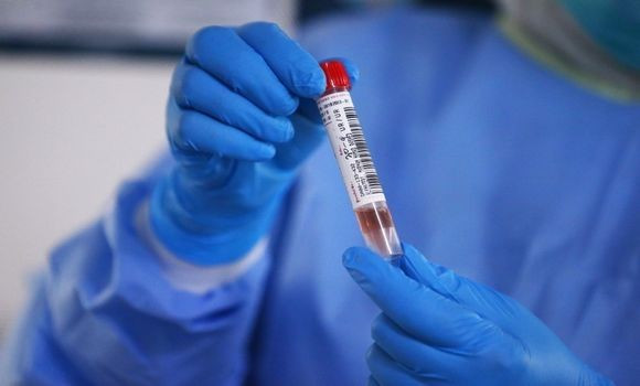Coronavirus: 170 nouveaux cas, 134 guérisons et 5 décès - Réveil d'algérie