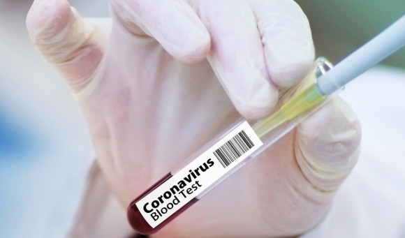 Coronavirus: 188 nouveaux cas, 214 guérisons et 7 décès - Réveil d'algérie