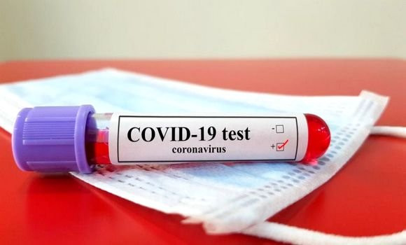 Coronavirus: 199 nouveaux cas, 154 guérisons et 7 décès - Réveil d'algérie