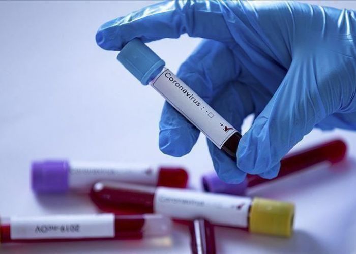 Coronavirus: 208 nouveaux cas, 131 guérisons et 6 décès ces dernières 24 heures en Algérie - Réveil d'algérie