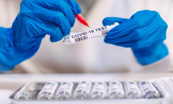 Coronavirus: 285 nouveaux cas, 189 guérisons et 7 décès - Réveil d'algérie