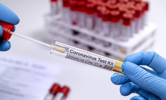 Coronavirus: 247 nouveaux cas, 151 guérisons et 8 décès - Réveil d'algérie