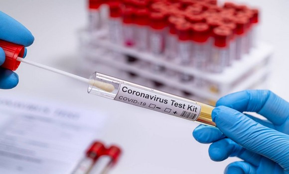 Coronavirus: 269 nouveaux cas, 206 guérisons et 5 décès - Réveil d'algérie