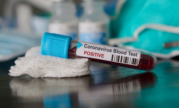Coronavirus: 322 nouveaux cas, 224 guérisons et 10 décès - Réveil d'algérie