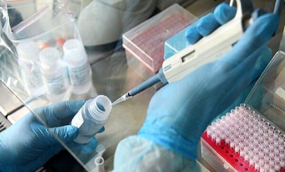 Coronavirus: 325 nouveaux cas, 215 guérisons et 9 décès - Réveil d'algérie