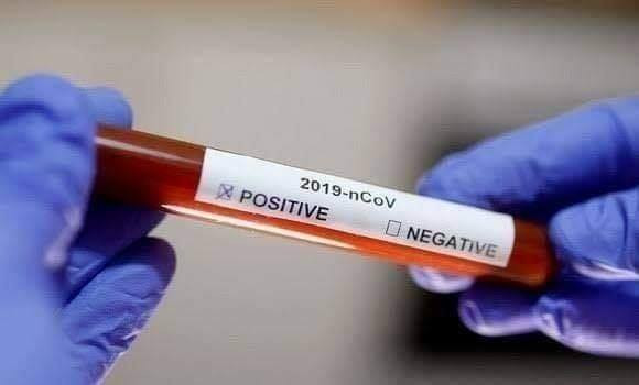 Coronavirus: 341 nouveaux cas, 230 guérisons et 7 décès - Réveil d'algérie