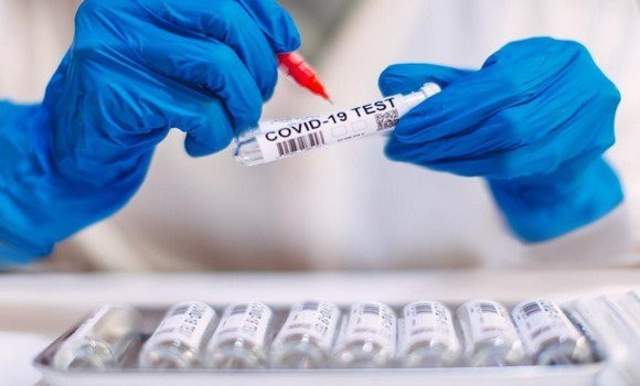 Coronavirus: 343 nouveaux cas, 236 guérisons et 5 décès - Réveil d'algérie