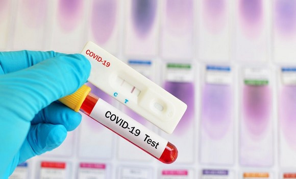Coronavirus: 375 nouveaux cas, 237 guérisons et 6 décès - Réveil d'algérie