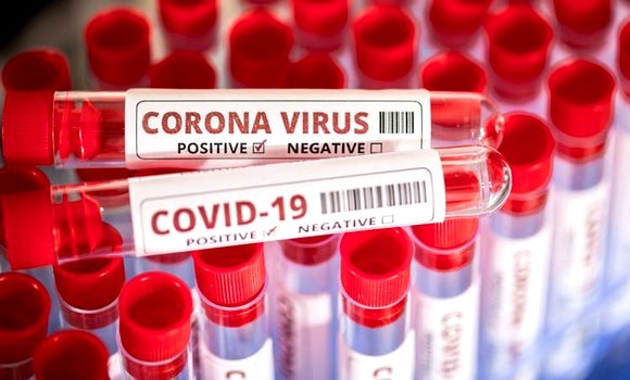 Covid-19: l’OMS utilisera les lettres grecques pour nommer les variants - Réveil d'algérie