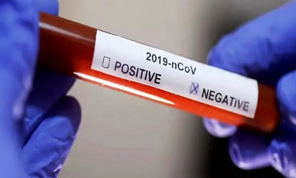 Coronavirus: 813 nouveaux cas, 528 guérisons et 13 décès ces dernières 24 heures en Algérie - Réveil d'algérie