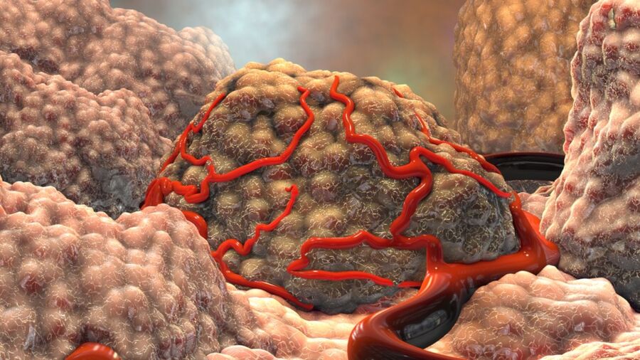 Columbia Engineering développe une technologie d’imagerie 3D pour détecter les cellules cancéreuses au lieu des biopsies. - Réveil d'algérie