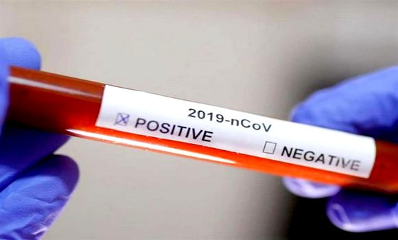 Coronavirus: 2 nouveaux cas et aucun décès ces dernières 24h - Réveil d'algérie