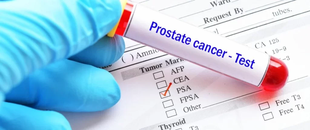 Cancer de la prostate - Réveil d'algérie