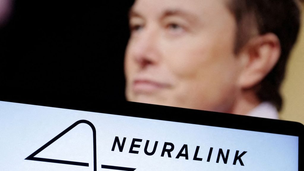 Elon Musk prévoit d’implanter des puces cérébrales sur des humains dès 2023. - Réveil d'algérie