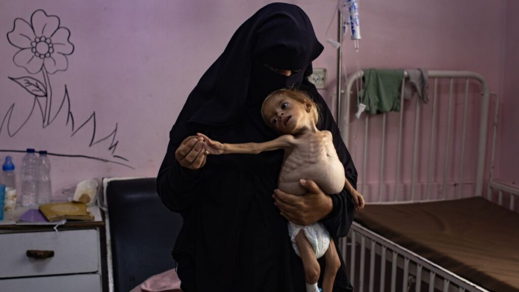 ONU : 500.000 Palestiniens en état catastrophique à cause de la famine à Ghaza - Réveil d'algérie